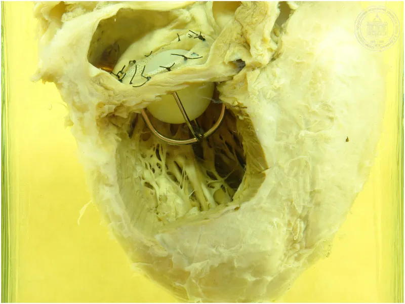Музей судебной медицины в Санкт-Петербурге