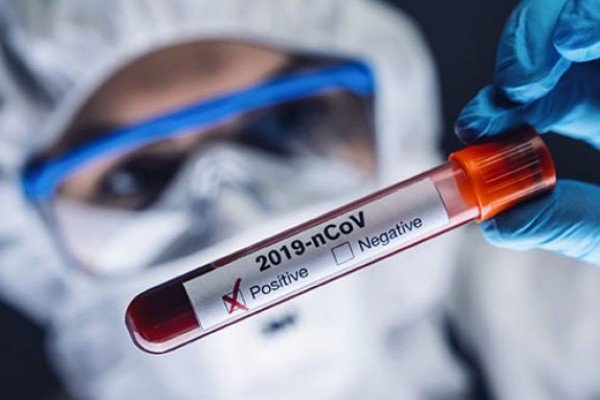 Зарубежные знаменитости, умершие от COVID-19: август-октябрь